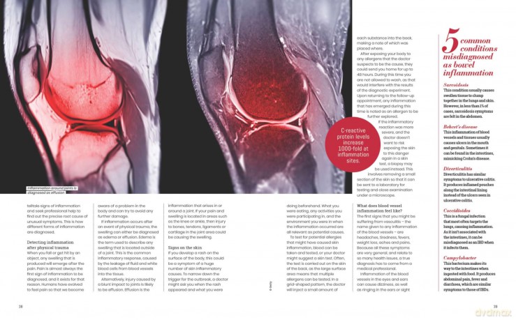 The Anti-Inflammatory Guide [KSIĄŻKA]