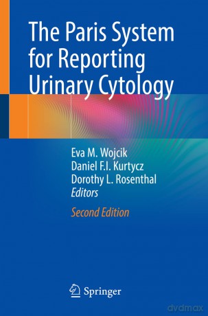 The Paris System for Reporting Urinary Cytology - Eva M. Wojcik [KSIĄŻKA]