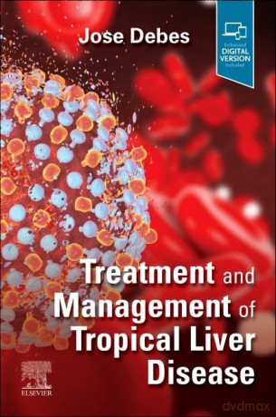 Treatment and Management of Tropical Liver Disease - A. E. Housman [KSIĄŻKA]