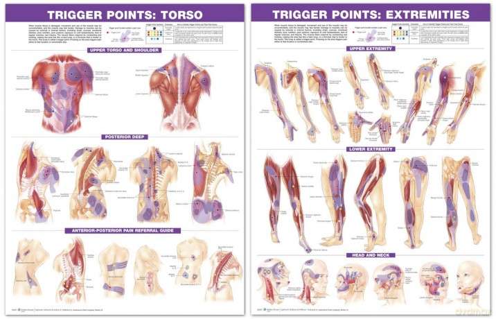 Trigger Point Chart Set: Torso and Extremities - Anatomical Chart Company [KSIĄŻKA]