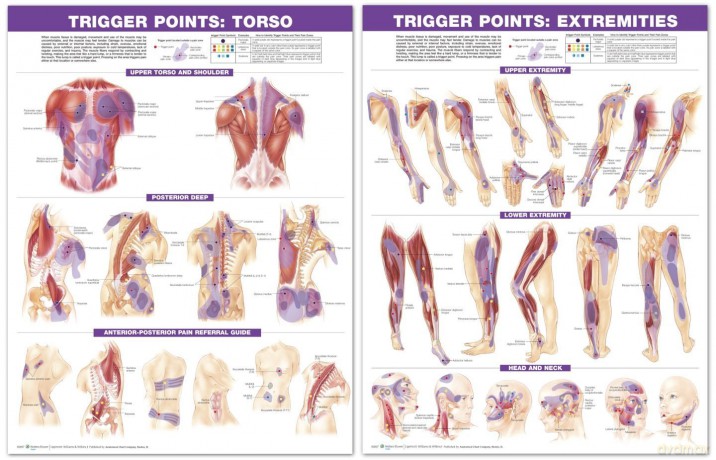 Trigger Point Chart Set: Torso and Extremities - Anatomical Chart Company [KSIĄŻKA]