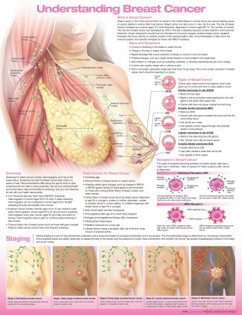 Understanding Breast Cancer Anatomical Chart - Anatomical Chart Company [KSIĄŻKA]