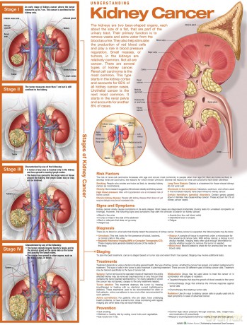 Understanding Kidney Cancer Anatomical Chart - Anatomical Chart Company [KSIĄŻKA]