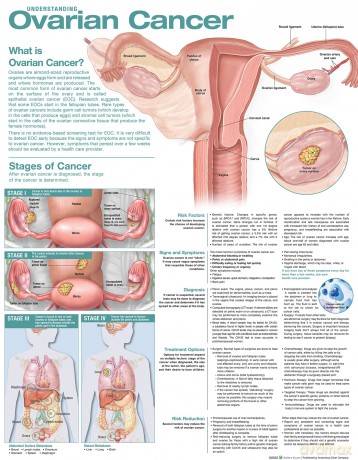 Understanding Ovarian Cancer Anatomical Chart - Anatomical Chart Company [KSIĄŻKA]