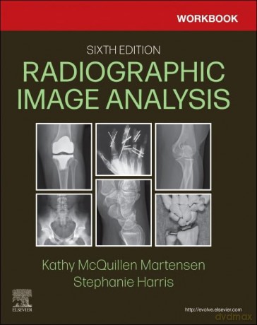Workbook for Radiographic Image Analysis - Mojang AB [KSIĄŻKA]