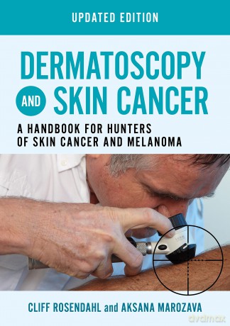 Dermatoscopy and Skin Cancer, updated edition: a handbook for hunters of skin cancer and melanoma (General Practice) [KSIĄŻKA]