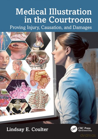 Medical Illustration in the Courtroom: Proving Injury, Causation, and Damages - Lindsay E. Coulter [KSIĄŻKA]