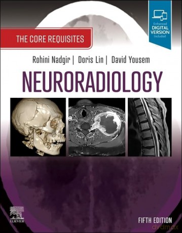 Neuroradiology: The Core Requisites - ohini Nadgir [KSIĄŻKA]