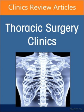 Surgical Conditions of the Diaphragm, An Issue of Thoracic Surgery Clinics (Volume 34-2) (The Clinics: Surgery, Volume 34-2) - rin Alexi Gillaspie [KSIĄŻKA]