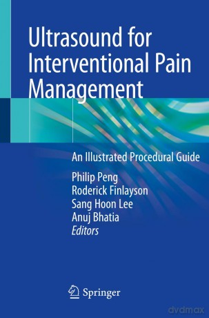 Ultrasound for Interventional Pain Management: An Illustrated Procedural Guide - Philip Peng [KSIĄŻKA]