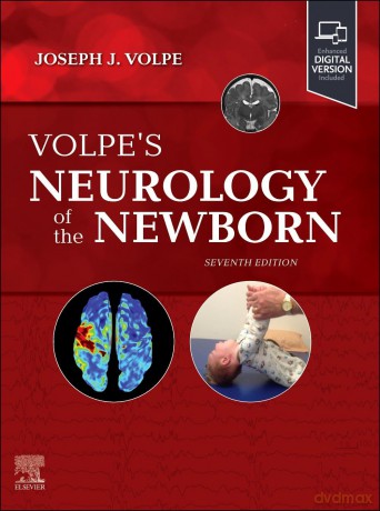 Volpe's Neurology of the Newborn - Joseph J. Volpe [KSIĄŻKA]