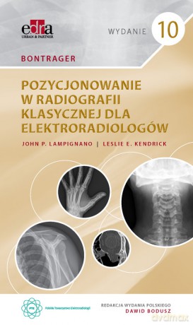 Bontrager. Pozycjonowanie w radiografii klasycznej dla elektroradiologów - J.P. Lampignano [KSIĄŻKA]