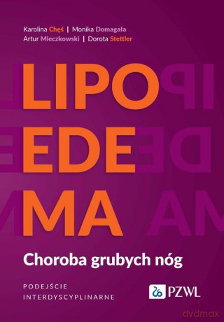 Lipoedema - Karolina Chęś, Monika Domagała [KSIĄŻKA]