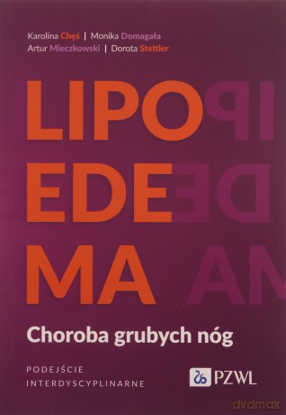 Lipoedema - Karolina Chęś, Monika Domagała [KSIĄŻKA]