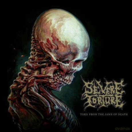 Severe Torture: Torn From The Jaws Of Death [Winyl]