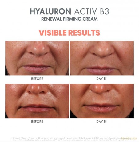 Avene Hyaluron Activ B3 Zellregenerieren