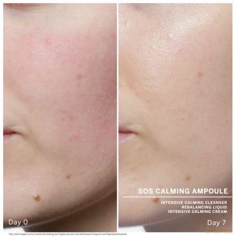 BABOR SOS Calming, Serum Ampullen für das Gesicht, Mit Aloe Vera und Panthenol für sofort beruhigte Haut, Ampoule Concentrates, 7 x 2 ml