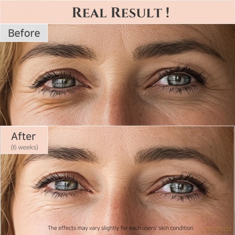 Beauty of Joseon wiederbeleben Augenserum: Ginseng + Retinal, 30 ml, 1fl.oz.
