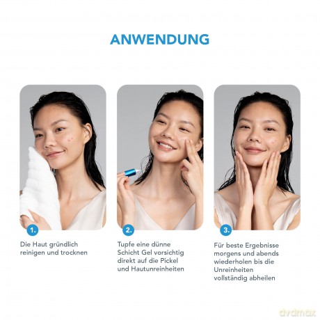 Foreo ESPADA BHA+PHA Blemish Solution 15 ml, Aknebehandlung&Mitesser-Entferner, Gesichtspflege, 2% Salicylsäure, Hamamelis, Teebaumöl, Niacinamid, Dermatologisch getestet, Tierversuchsfrei&Vegan, Blue