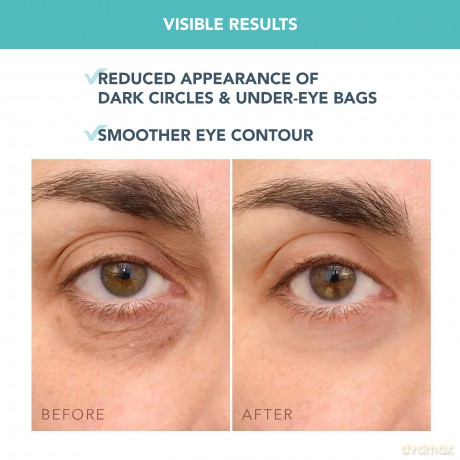 FOREO IRIS Vitamin C Eye Cream - Augencreme Gegen Falten und Augenringe - Vitamin E - Koffein - Hyaluronsäure - Yerba Mate - Kakaobutter - Vegan Kosmetik - Augenringe Entfernen und Tränensäcke - 15 ml