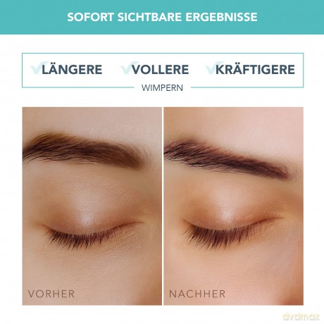 FOREO IRIS Wimpernserum - Volumen, Schutz und Kraft - Wimpernserum Wachstum - Konzentriertes Wimpernserum - Phytokeratin, Arginin und Hyaluronsäure - Ohne Duftstoffe - Alle Hauttypen - 4.3 ml