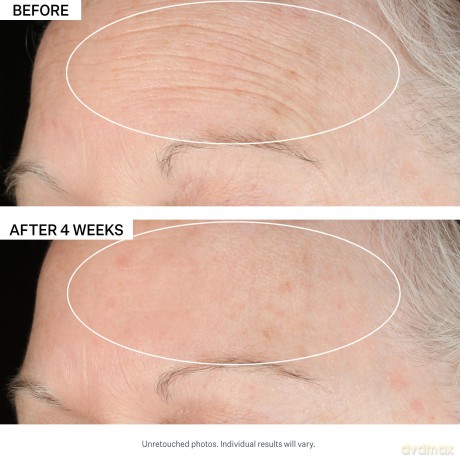 Get Plumped Anti-Wrinkle Gift Set