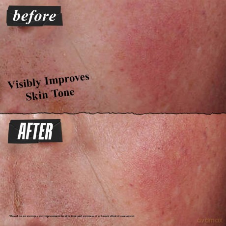 KIEHL´S Ultra Facial Advanced Repair Barrier Cream, 50 ml