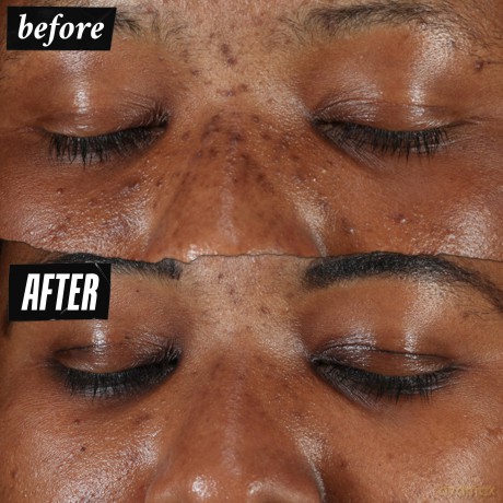 Kiehls Clearly Corrective Dark Spot Solution 100ml