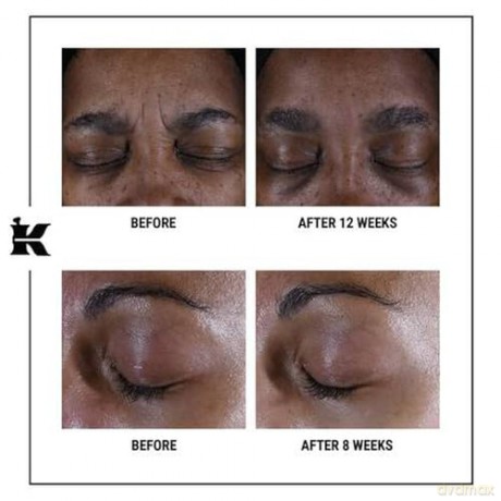 Kiehl's Super Multi-Corrective Eye Zone Treatment