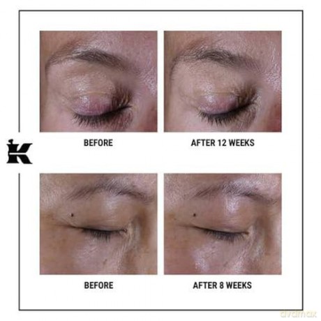 Kiehl's Super Multi-Corrective Eye Zone Treatment