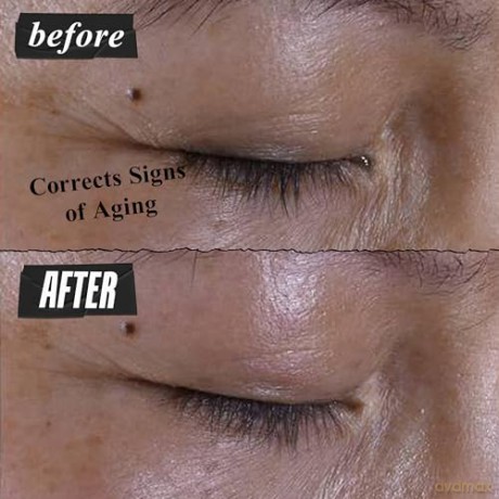 Kiehl's Super Multi-Corrective Eye Zone Treatment, 28 ml