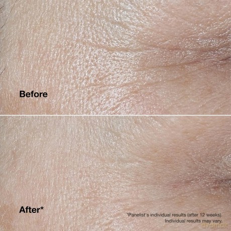 Smart Clinical Repair Wrinkle Correct ing Cream for mature skin - Volume: 75 ml