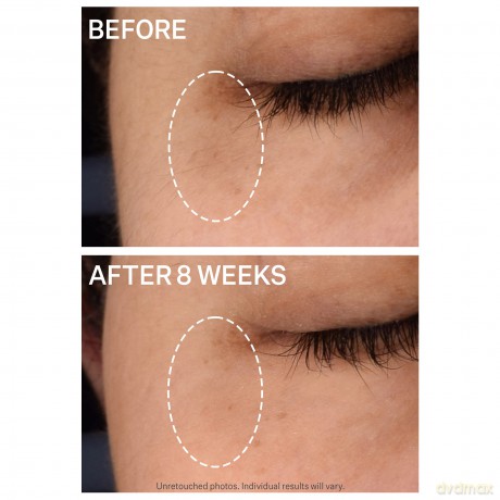 StriVectinMULTI-ACTION SUPER-C dark circle brightening eye serum 15 ml