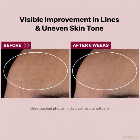 StriVectinStriVectin Retinol Nightly Multi-Correct Serum, Visibly Reducing Fines Lines and Wrinkles, Restores Elasticity