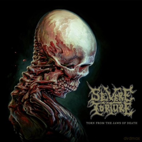 Severe Torture: Torn From The Jaws Of Death (digipack) [CD]