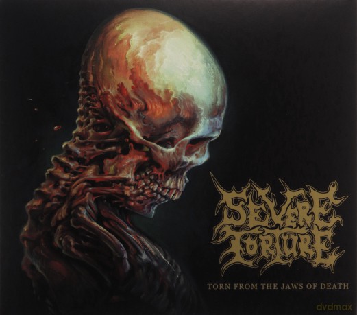 Severe Torture: Torn From The Jaws Of Death (digipack) [CD]