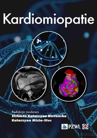 Kardiomiopatie - Katarzyna Biernacka Elżbieta, KatarzynaMizia-Stec [KSIĄŻKA]