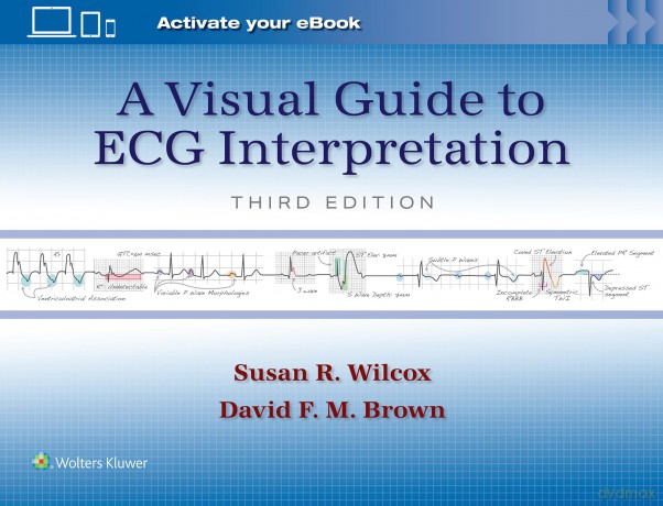 A Visual Guide to ECG Interpretation: Print + eBook with Multimedia - Susan R Wilcox [KSIĄŻKA]