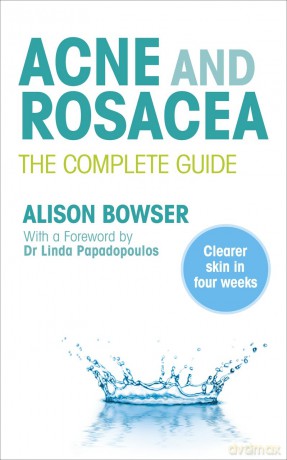 Acne and Rosacea: The Complete Guide - Alison Bowser [KSIĄŻKA]