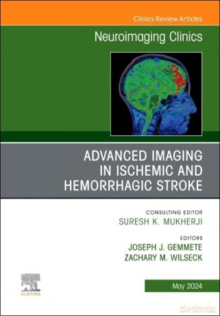 Advanced Imaging in Ischemic and Hemorrhagic Stroke, An Issue of Neuroimaging Clinics of North America (Volume 34-2) (The Clinics: Radiology, Volume 34-2) - Joseph J. Gemmete [KSIĄŻKA]