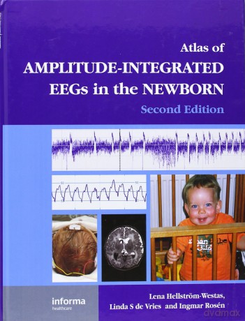 An Atlas of Amplitude-Integrated EEGs in the Newborn (Encyclopedia of Visual Medicine Series) - Le Hellstrom-Westas [KSIĄŻKA]