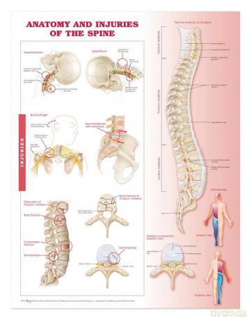 Anatomy and Injuries of the Spine: Anatomical Chart [KSIĄŻKA]