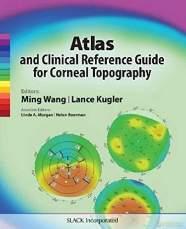 Atlas and Clinical Reference Guide for Corneal Topography - Ming Wang [KSIĄŻKA]