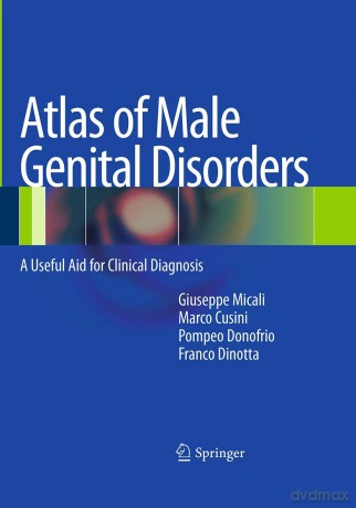 Atlas of Male Genital Disorders: A Useful Aid for Clinical Diagnosis - Giuseppe Micali [KSIĄŻKA]
