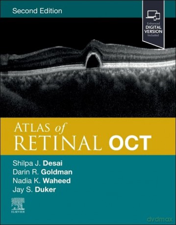 Atlas of Retinal OCT: Optical Coherence Tomography - Jay S. Duker [KSIĄŻKA]