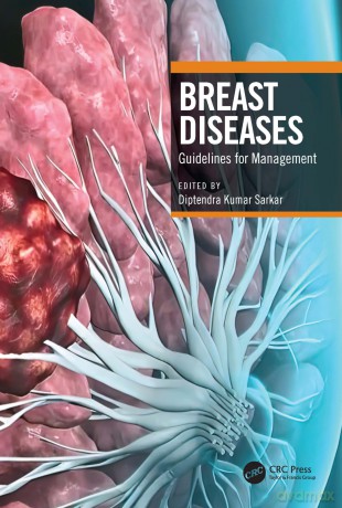 Breast Diseases: Guidelines for Management - Diptendra Ku Sarkar [KSIĄŻKA]