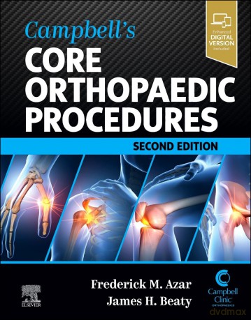 Campbell's Core Orthopaedic Procedures - Frederick M. Azar [KSIĄŻKA]