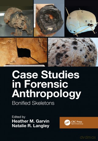 Case Studies in Forensic Anthropology: Bonified Skeletons - Heather M. Garvin [KSIĄŻKA]