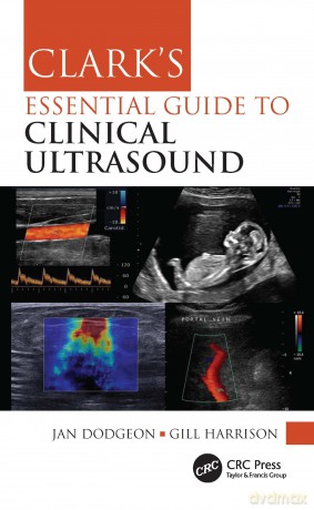 Clark's Essential Guide to Clinical Ultrasound (Clark's Companion Essential Guides) - Jan Dodgeon [KSIĄŻKA]