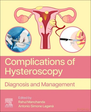 Complications of Hysteroscopy: Diagnosis and Management - Rahul Manchanda [KSIĄŻKA]